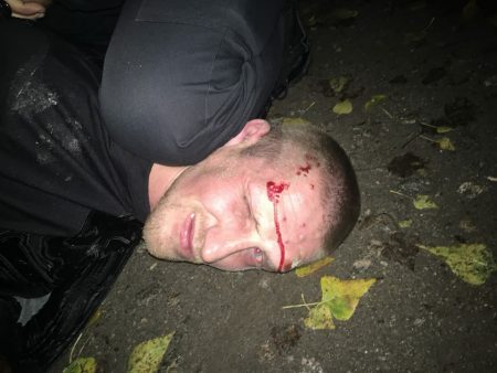 Гопники, які підрізали замкомбата патрульної поліції Кропивницького, відмовилися від наркологічної експертизи