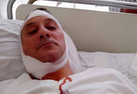 «Бив ногами, переважно в голову», – після операції потерпілий розповів, як і за що його побив працівник СБУ