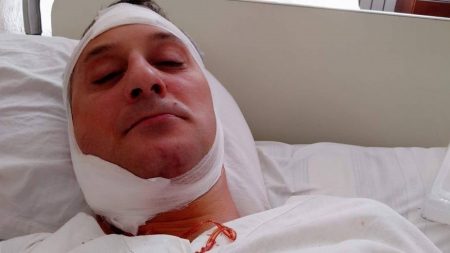 Військова прокуратура перекваліфікувала статтю в справі про побиття працівником СБУ жителя Гайворона