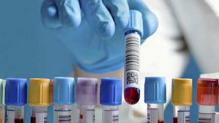 Столичні медпостачальники вдруге засвітилися у змові, продаючи реагенти Кіровоградській обласній дитячій лікарні