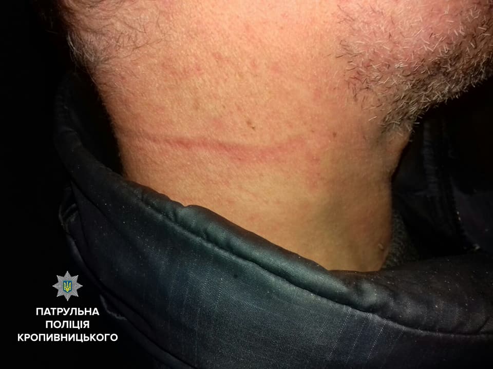 Невдале самогубство: поліцейські не дали чоловіку повішатись після побиття матері. ФОТО