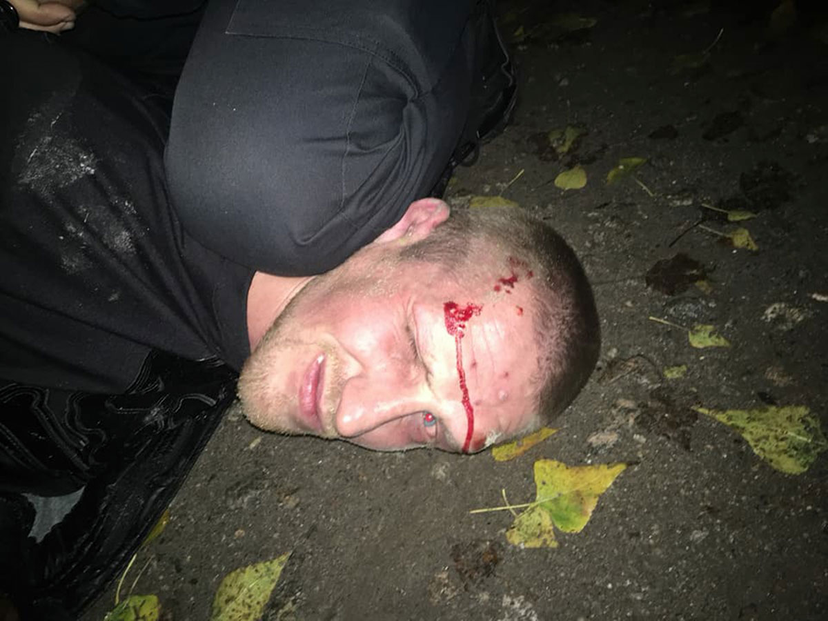 Завдяки кому відпустили підозрюваного в нанесенні ножового поранення замкомбату патрульних Кропивницького