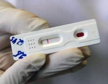 Медзаклади Кіровоградщини отримали від благодійників майже 1 500 експрес-тестів для діагностики ВІЛ