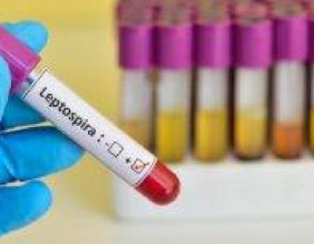 У мешканця Кіровоградщини підтвердився діагноз лептоспіроз
