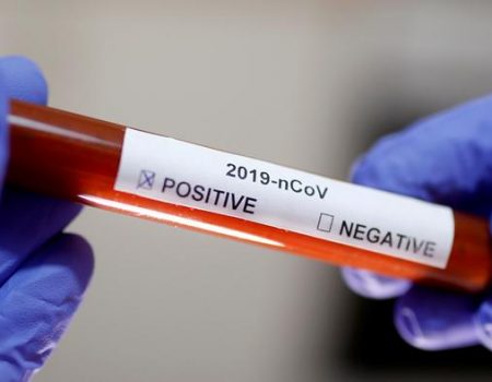 Кіровоградщина: тести на коронавірус мають з’явитись цього тижня