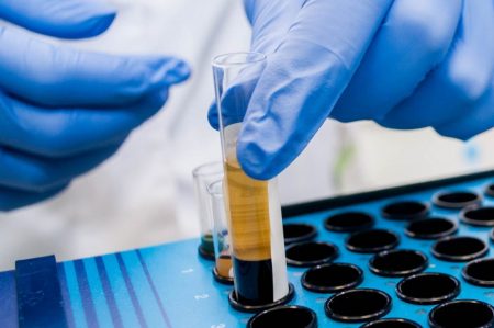 Поліція призначила експертизу останків голови, знайденої на території селища Нового
