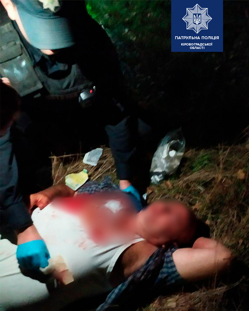 У Кропивницькому на вулиці &#8220;підрізали&#8221; чоловіка