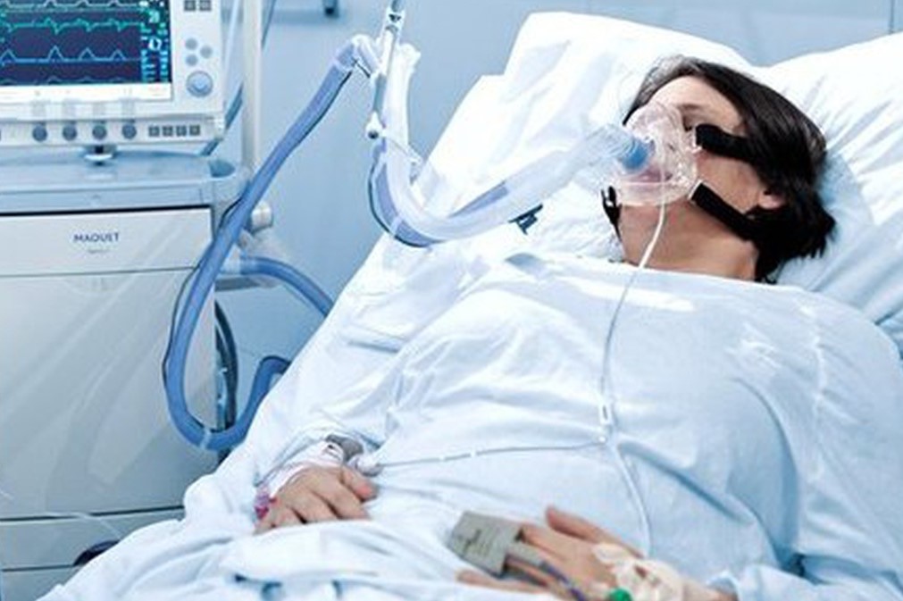 На Кіровоградщині 25 тяжко хворих на COVID-19 підключені до апаратів штучної вентиляції легень