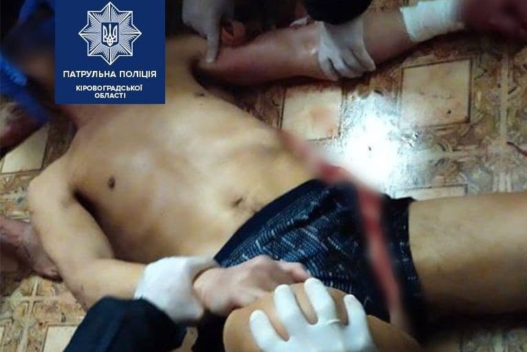 У Кропивницькому патрульні врятували чоловіка, який порізав собі вени. ФОТО