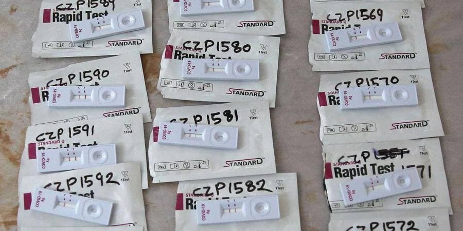 Кіровоградщина отримала 44 тисячі експрес-тестів на антиген COVID-19