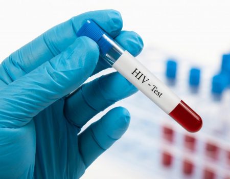 На Кіровоградщині майже 5 тисяч хворих на ВІЛ та СНІД, за 9 місяців померло – 43