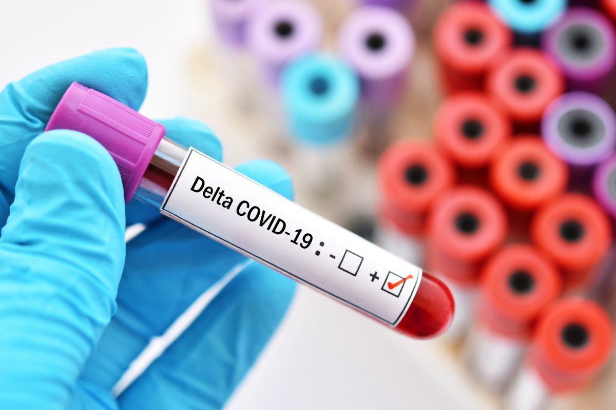 17 випадків коронавіруса штаму Delta виявили на Кіровоградщині за тиждень