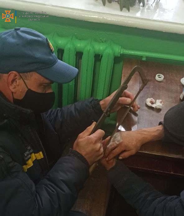 На Кіровоградщині лікар викликав рятувальників, щоб врятувати палець пацієнта. ФОТО