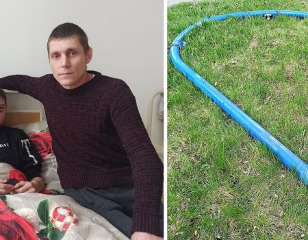 На Кіровоградщині на підлітка впала гойдалка, в нього – переломи кісток черепа