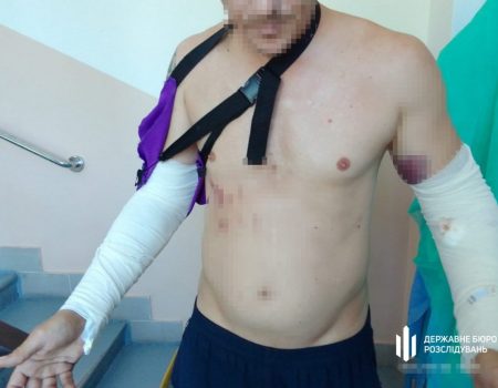 Громадська організація добивається якісного знеболення для невиліковно хворих Кіровоградщини